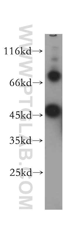 17749-1-AP;HEK-293 cells