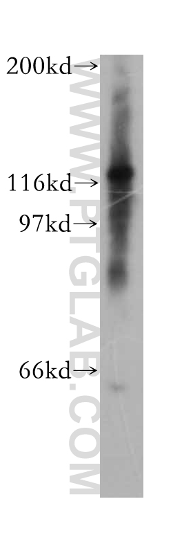 13030-1-AP;Y79 cell