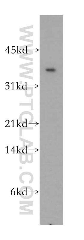 12638-1-AP;mouse liver tissue