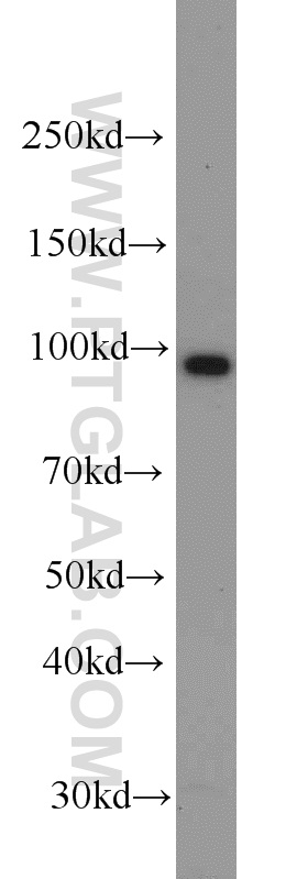 11813-1-AP;K-562 cells