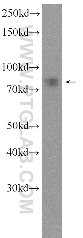 12132-1-AP;fetal human brain tissue