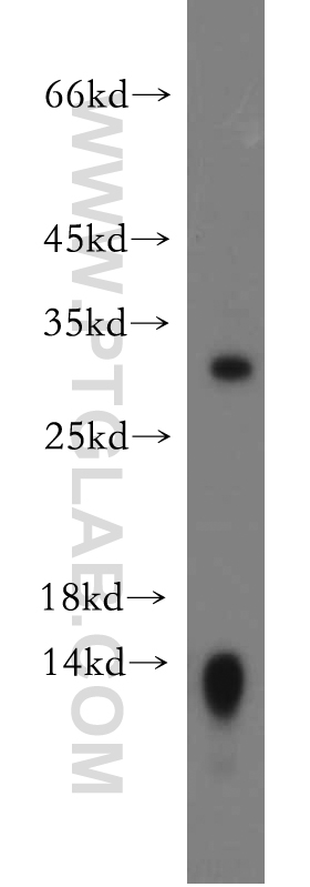 21126-1-AP;mouse kidney tissue