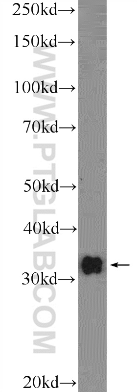 26077-1-AP;mouse brain tissue