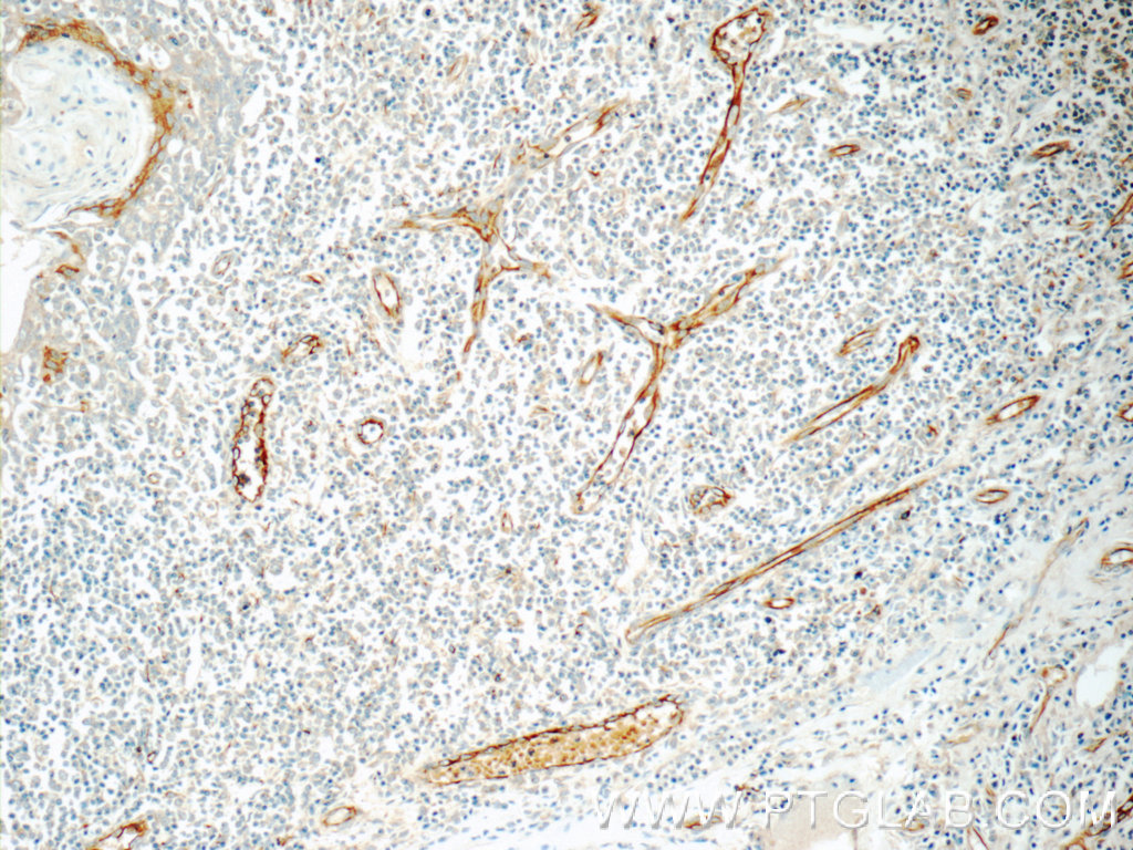 22003-1-AP;human tonsillitis tissue