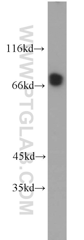 10470-1-AP;HeLa cells