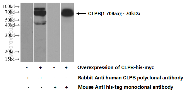 15743-1-AP;Transfected HEK-293 cells