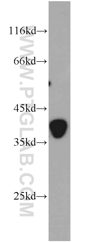 10852-1-AP;mouse brain tissue