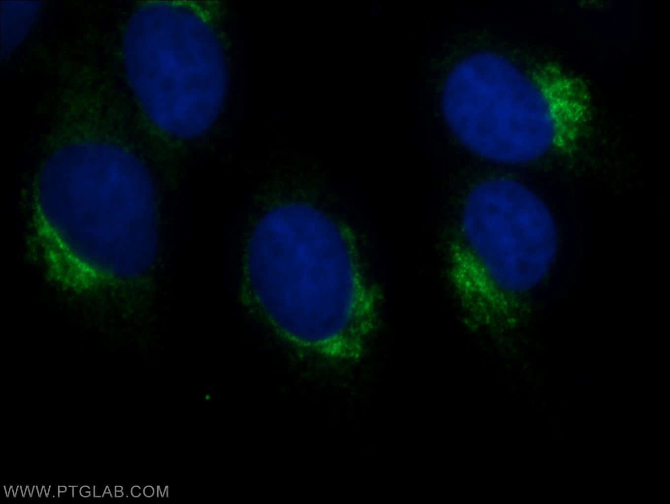 17470-1-AP;MDCK cells