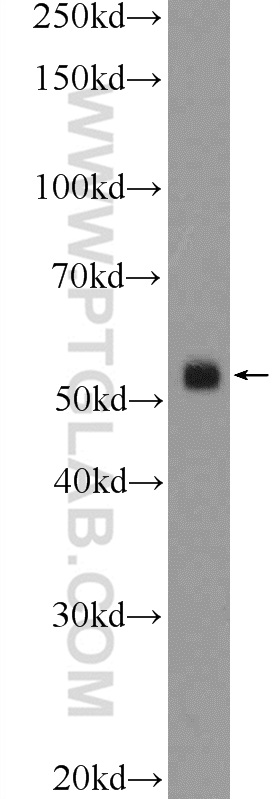 17470-1-AP;mouse testis tissue