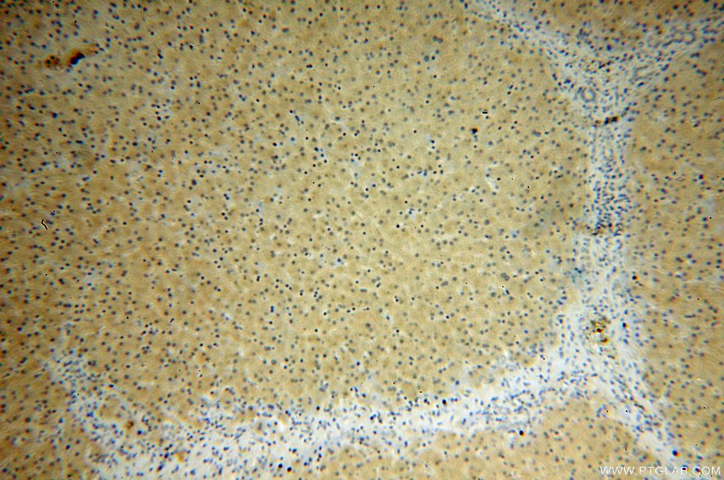 17314-1-AP;human liver