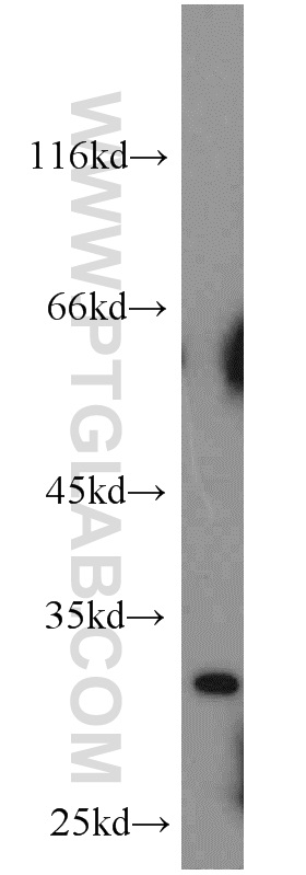 18189-1-AP;mouse heart tissue