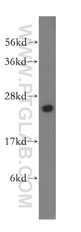 11360-1-AP;human pancreas tissue