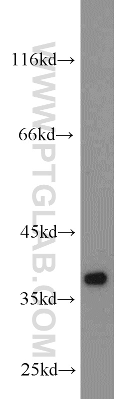 13938-1-AP;mouse heart tissue