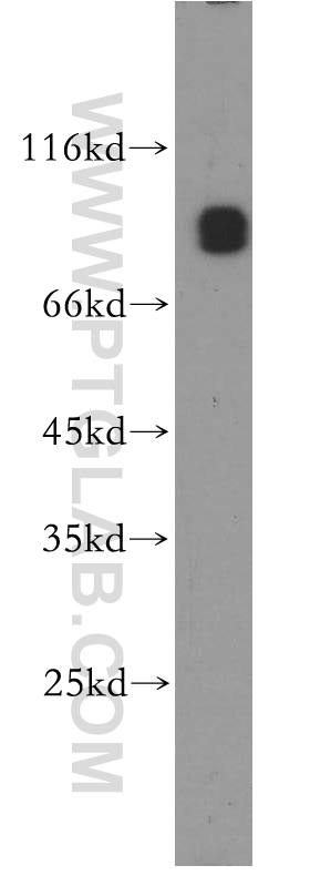 13976-1-AP;K-562 cells