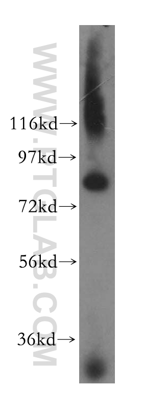 15938-1-AP;human brain tissue