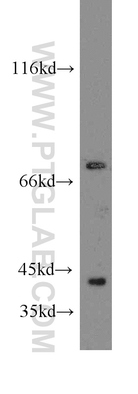 14277-1-AP;human brain tissue