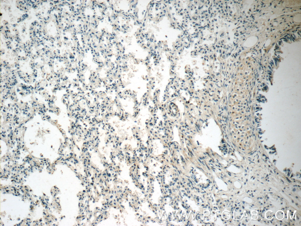 15943-1-AP;human lung tissue