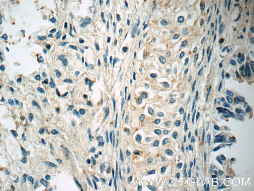 15943-1-AP;human lung tissue