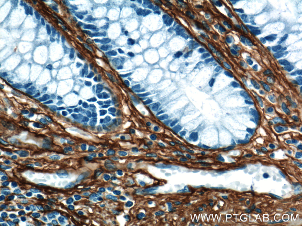 22734-1-AP;human colon tissue