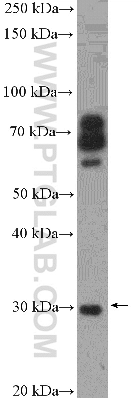 14754-1-AP;mouse liver tissue