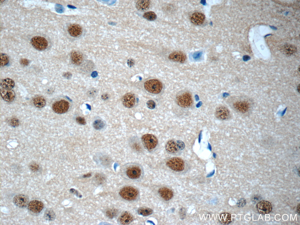 10089-2-AP;mouse brain tissue