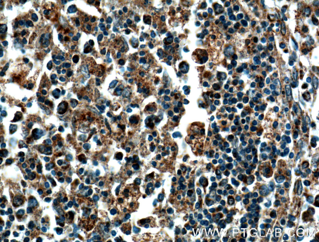 Cox Cyclooxygenase Ptgs Antibody Ap Proteintech