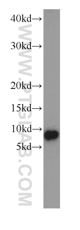 11413-1-AP;mouse heart tissue