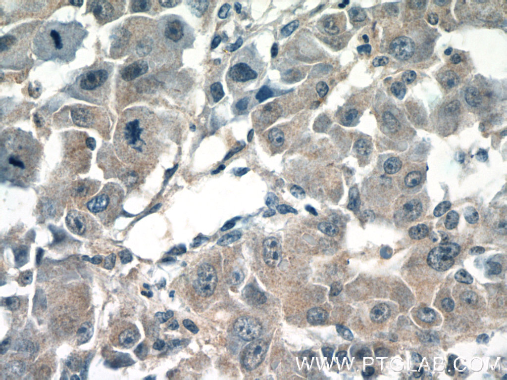 13274-1-AP;human liver cancer tissue