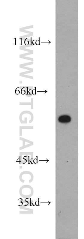 13274-1-AP;A375 cells