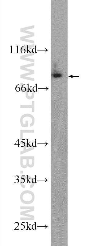 25342-1-AP;A375 cells