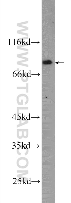 25342-1-AP;SH-SY5Y cells