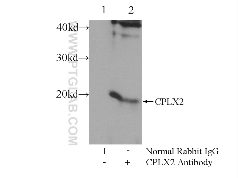 18149-1-AP;SH-SY5Y cells