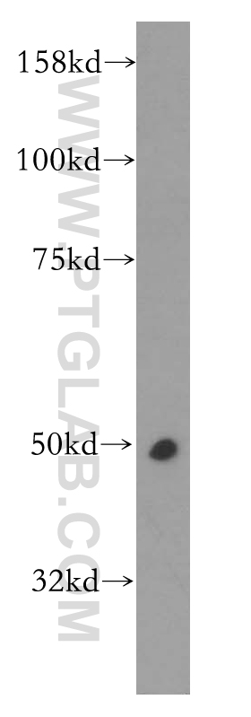 13385-1-AP;Raji cells