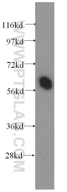 11186-1-AP;Y79 cell