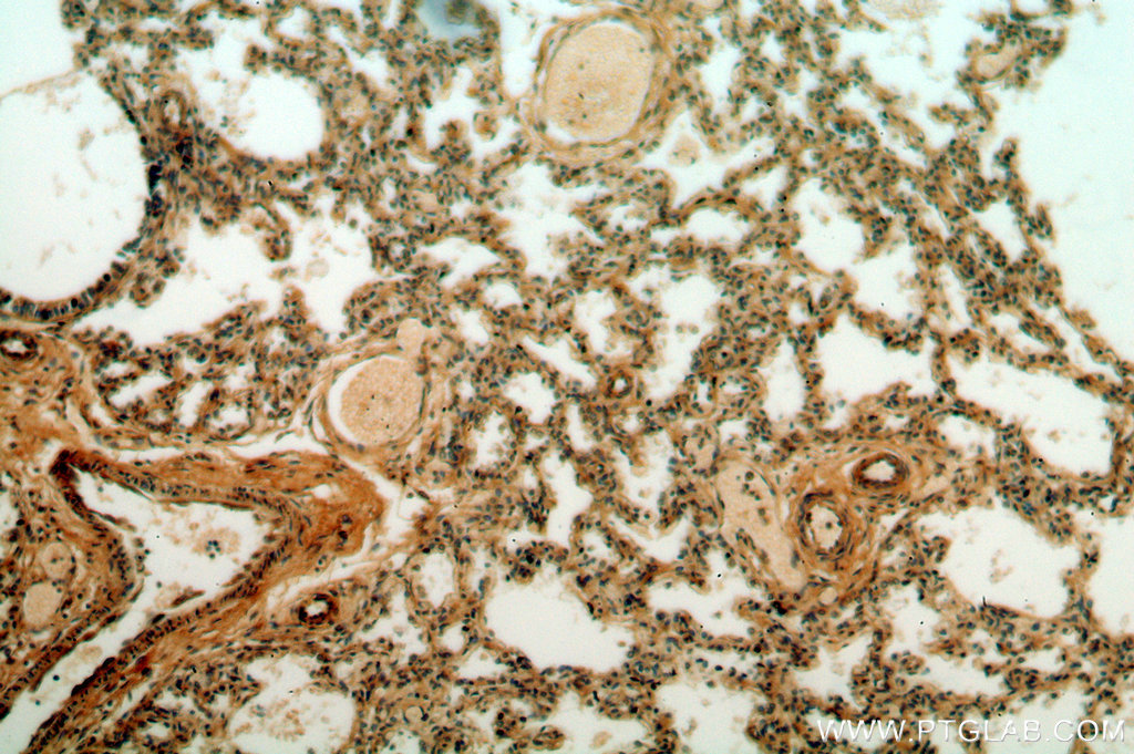 20097-1-AP;human lung tissue