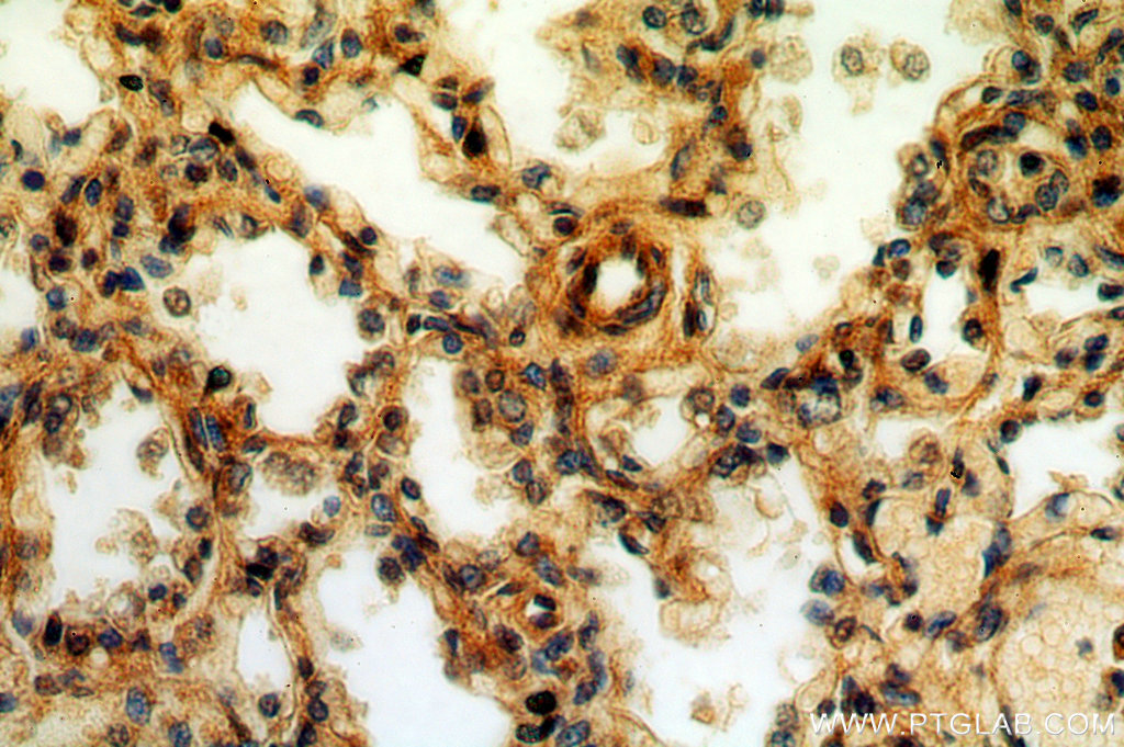 20097-1-AP;human lung tissue