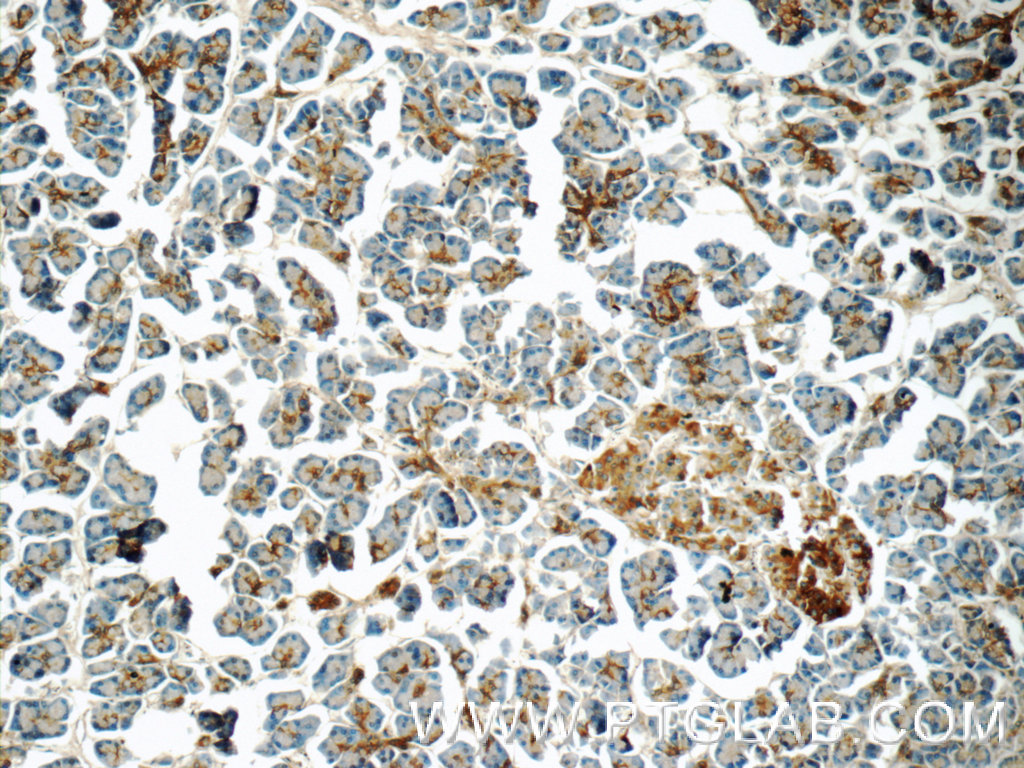 14847-1-AP;human pancreas tissue