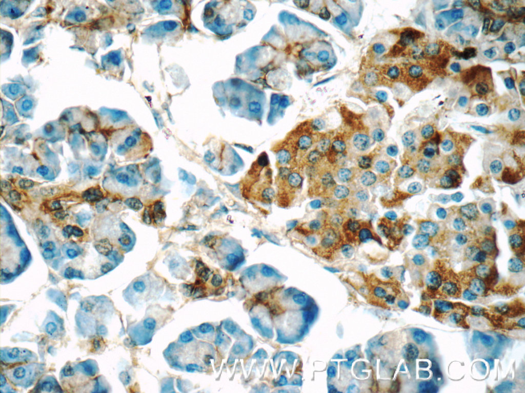 14847-1-AP;human pancreas tissue