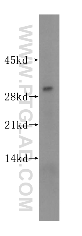 14847-1-AP;human placenta tissue