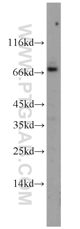 11799-1-AP;mouse brain tissue