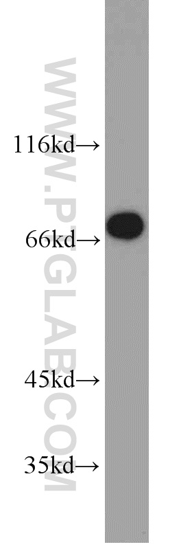 10441-1-AP;mouse kidney tissue