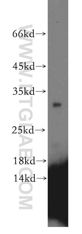 13760-1-AP;MCF7 cell