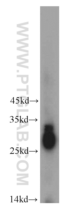 21009-1-AP;mouse eye tissue