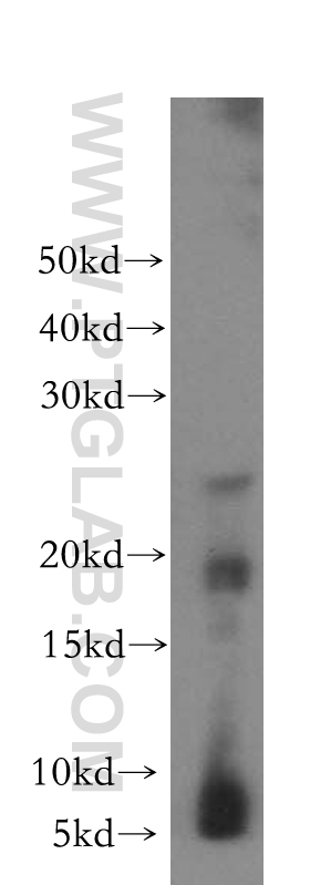 17931-1-AP;human brain tissue