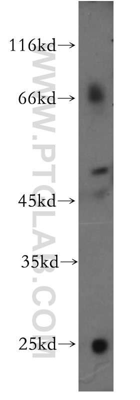 18307-1-AP;HepG2 cell