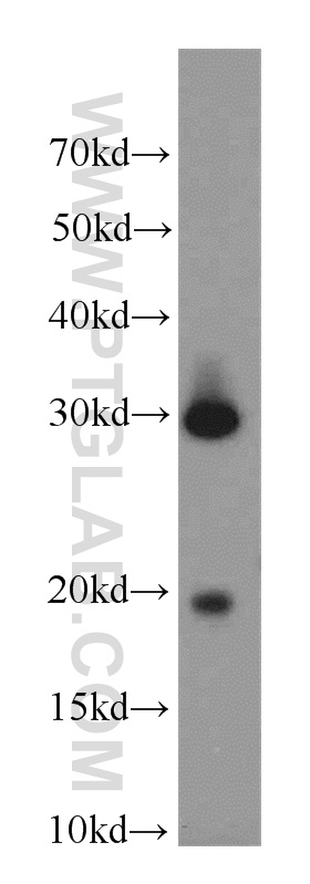 18183-1-AP;human testis tissue