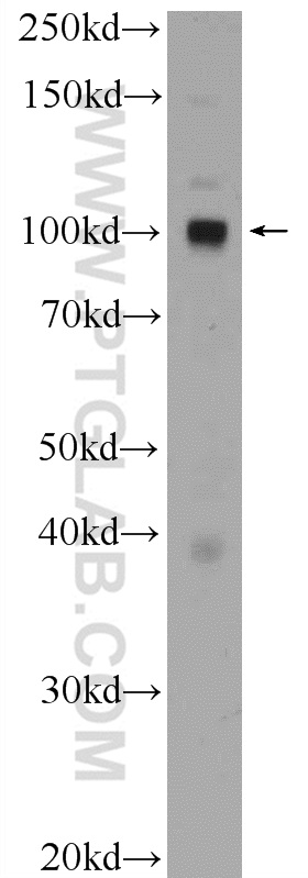 17438-1-AP;HeLa cells