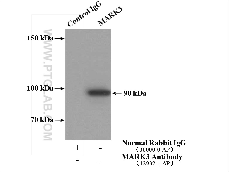 12932-1-AP;mouse brain tissue