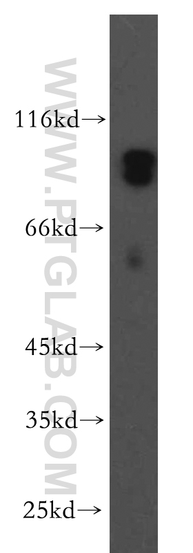 12932-1-AP;human brain tissue