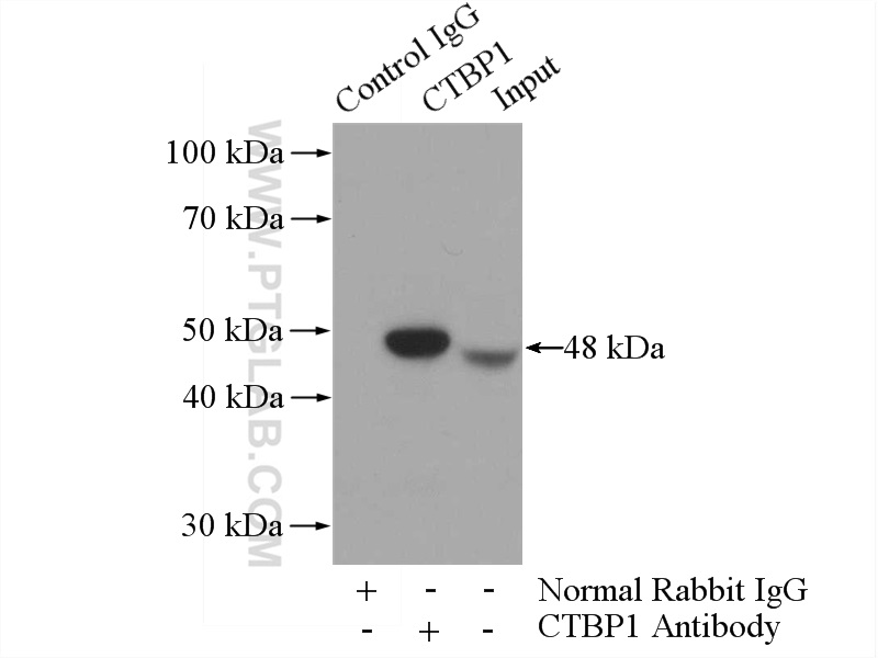 10972-1-AP;mouse brain tissue